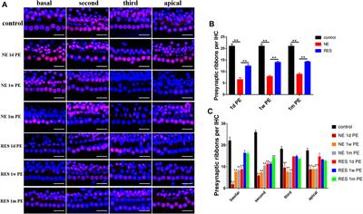 Involvement of the SIRT1/PGC-1α Signaling Pathway in Noise-Induced Hidden Hearing Loss